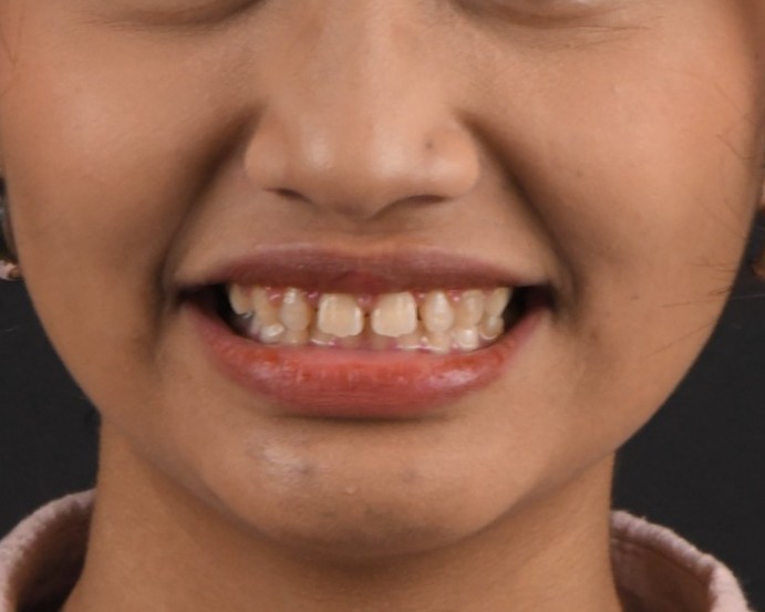 Dental Case 1 Before