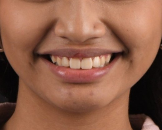 Dental Case 1 After